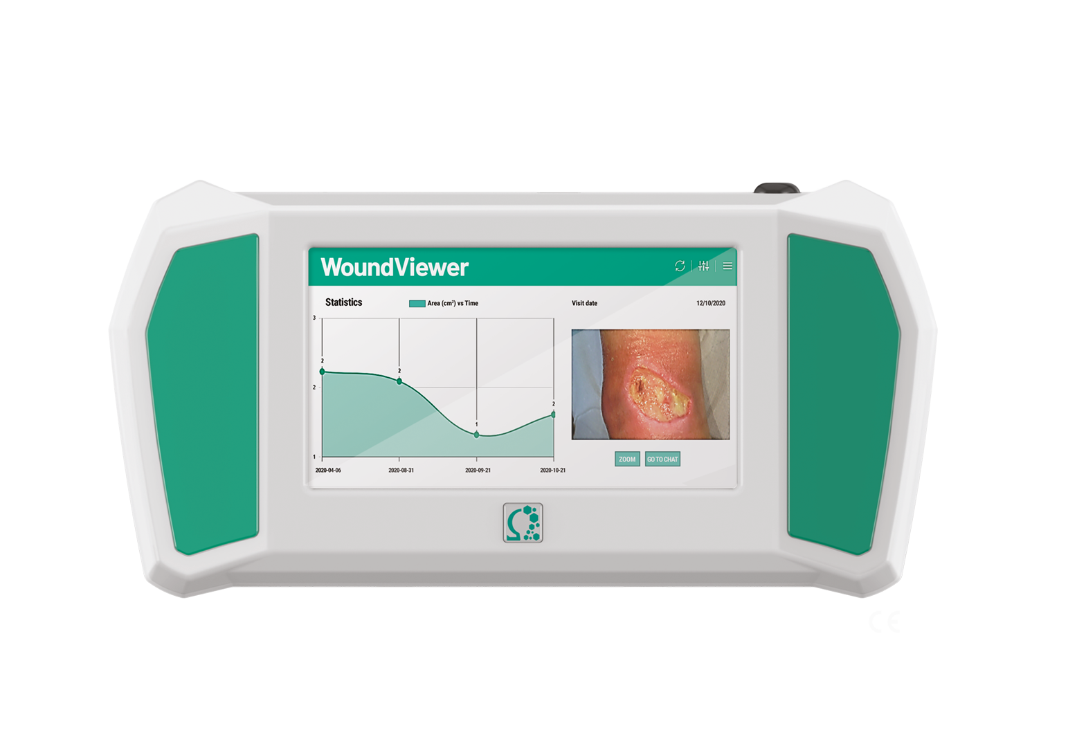 WOUNDVIEWER